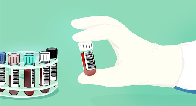 進口胎牛血清關需要什么資質？